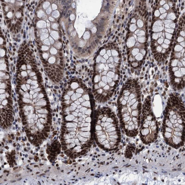 GALNT11 Antibody in Immunohistochemistry (Paraffin) (IHC (P))