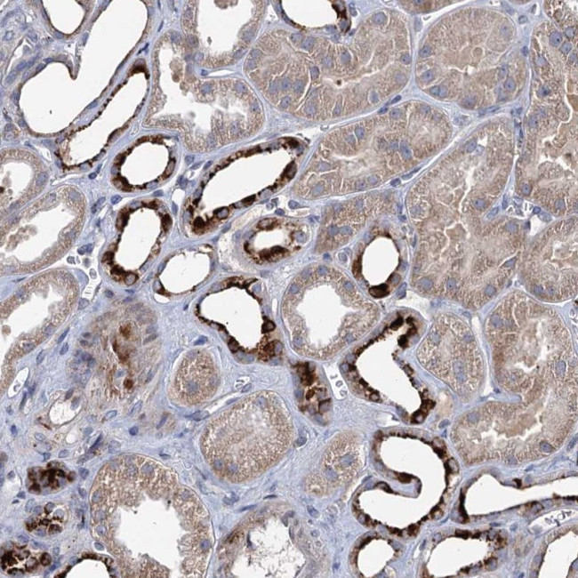 C11orf86 Antibody in Immunohistochemistry (Paraffin) (IHC (P))
