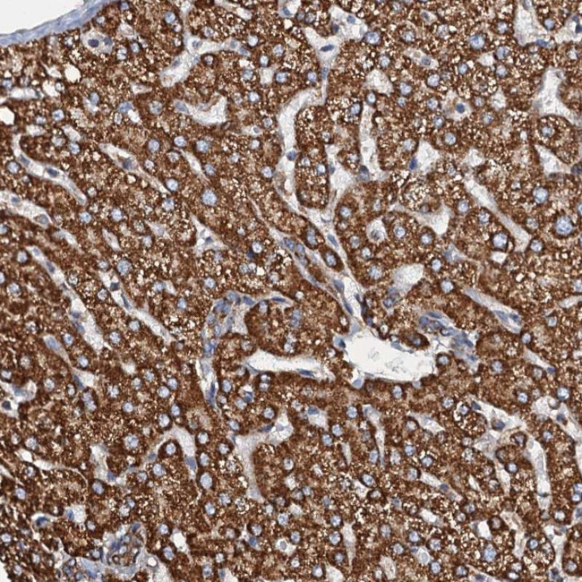 AAGAB Antibody in Immunohistochemistry (Paraffin) (IHC (P))