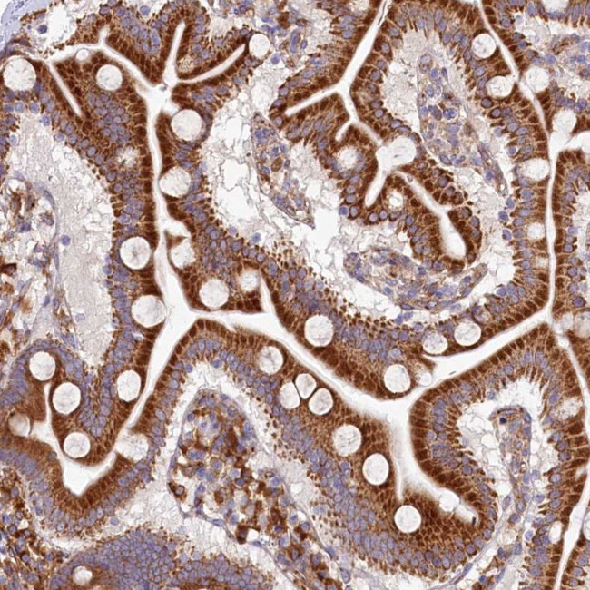 SI-CLP Antibody in Immunohistochemistry (Paraffin) (IHC (P))