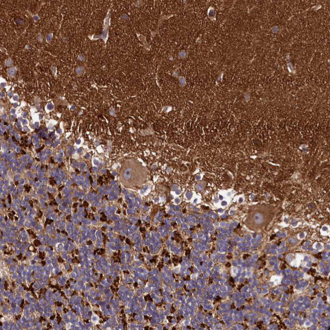 DMXL2 Antibody in Immunohistochemistry (IHC)