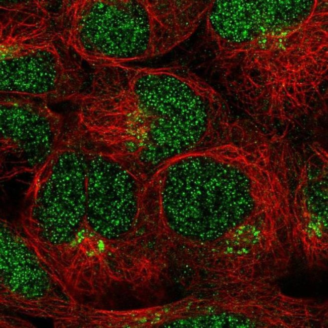 LRRC28 Antibody in Immunocytochemistry (ICC/IF)