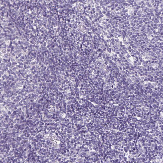 SH3GL3 Antibody in Immunohistochemistry (Paraffin) (IHC (P))