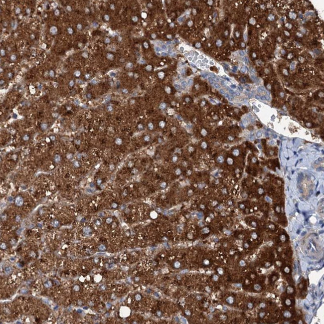 SLC22A25 Antibody in Immunohistochemistry (Paraffin) (IHC (P))
