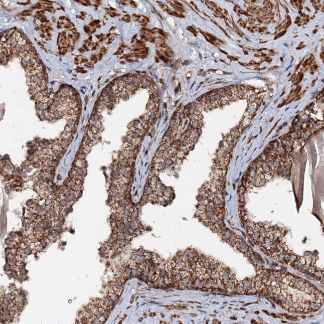 CEP76 Antibody in Immunohistochemistry (Paraffin) (IHC (P))