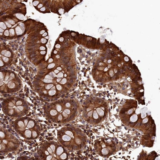 LCMT2 Antibody in Immunohistochemistry (IHC)