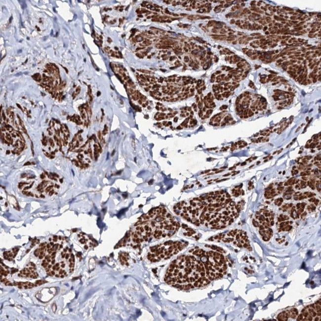 MOCOS Antibody in Immunohistochemistry (Paraffin) (IHC (P))