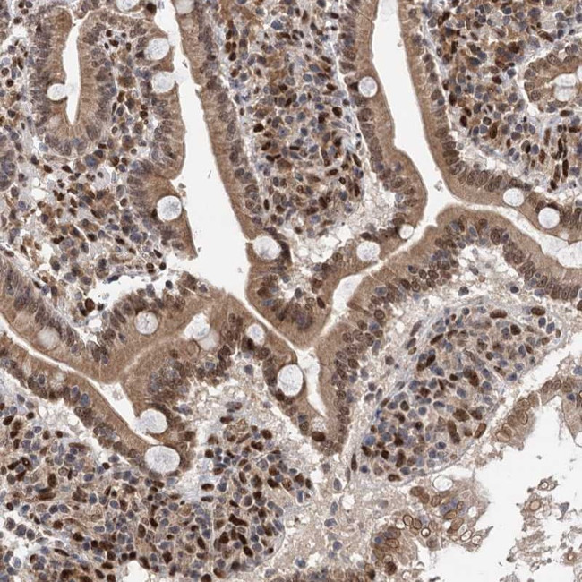 MESDC2 Antibody in Immunohistochemistry (Paraffin) (IHC (P))