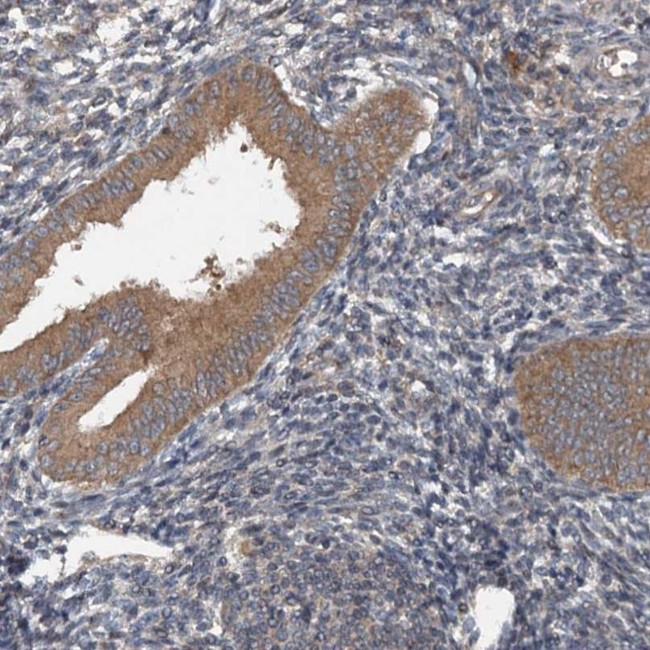 N4BP2L2 Antibody in Immunohistochemistry (IHC)