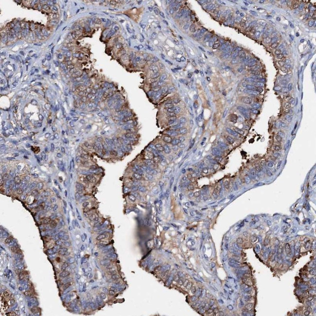 MANSC4 Antibody in Immunohistochemistry (Paraffin) (IHC (P))