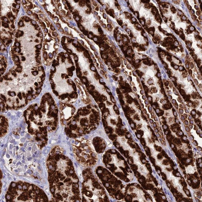 DHDPSL Antibody in Immunohistochemistry (Paraffin) (IHC (P))