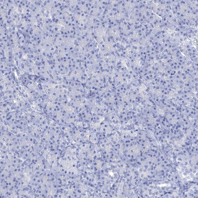NALP14 Antibody in Immunohistochemistry (Paraffin) (IHC (P))