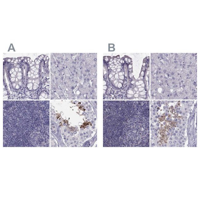 FAM71B Antibody in Immunohistochemistry (IHC)