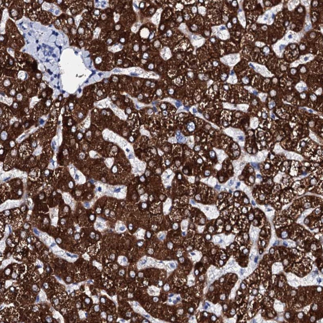 GYS2 Antibody in Immunohistochemistry (Paraffin) (IHC (P))