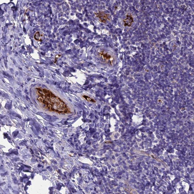 TCP11L2 Antibody in Immunohistochemistry (Paraffin) (IHC (P))