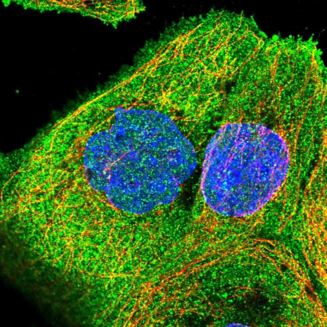 ANKRD13A Antibody in Immunocytochemistry (ICC/IF)