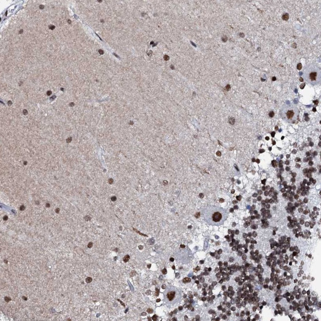 C11orf57 Antibody in Immunohistochemistry (Paraffin) (IHC (P))