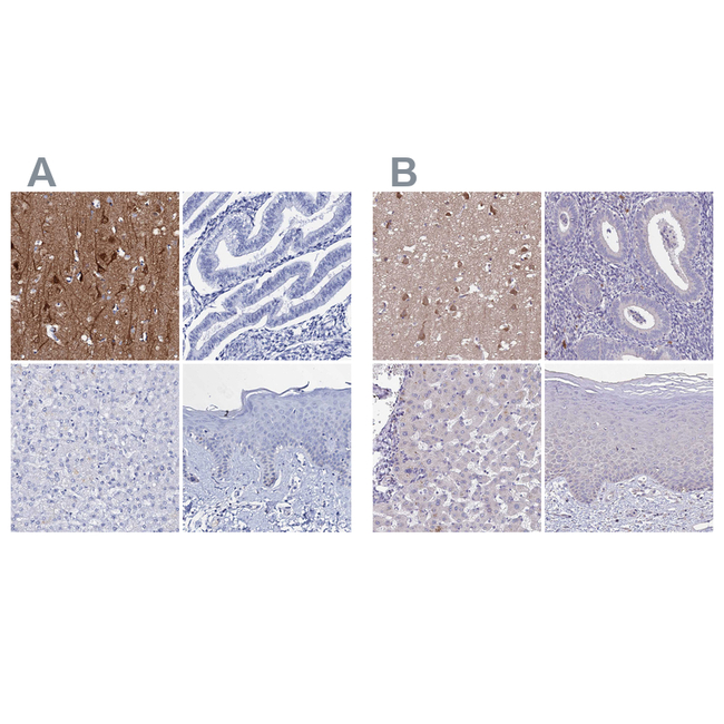 FBXL16 Antibody in Immunohistochemistry (Paraffin) (IHC (P))