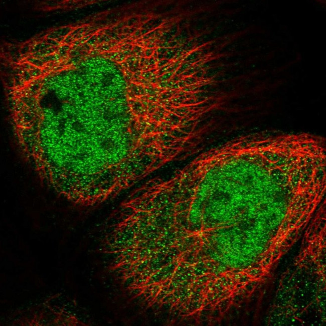 SPR Antibody in Immunocytochemistry (ICC/IF)
