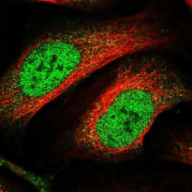 ZNF549 Antibody in Immunocytochemistry (ICC/IF)
