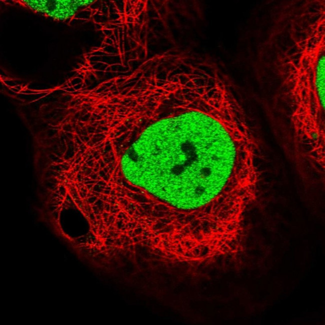 PDS5B Antibody in Immunocytochemistry (ICC/IF)