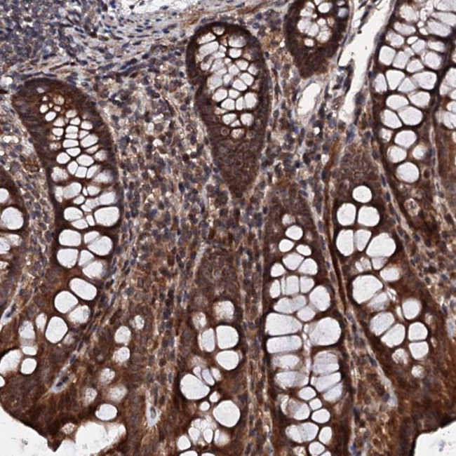 FAM111A Antibody in Immunohistochemistry (Paraffin) (IHC (P))