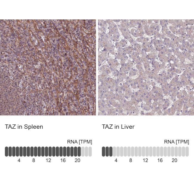 TAZ Antibody in Immunohistochemistry (IHC)
