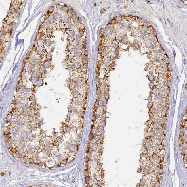 DONSON Antibody in Immunohistochemistry (Paraffin) (IHC (P))