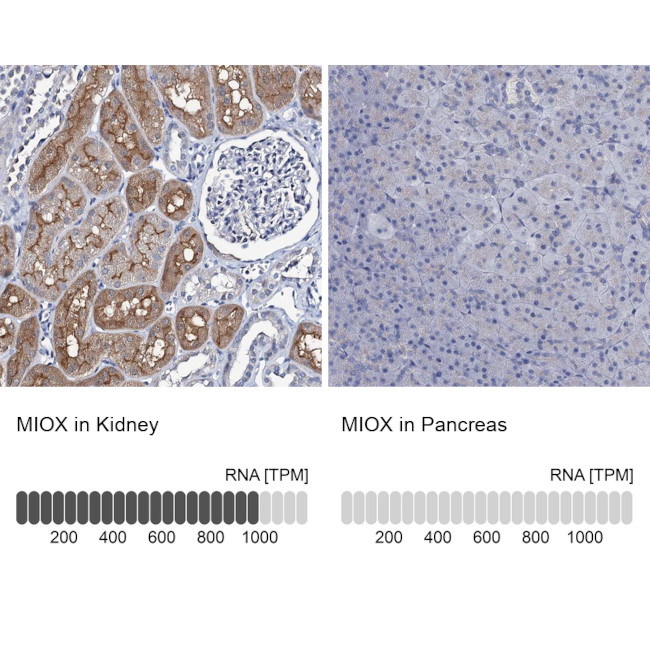 MIOX Antibody in Immunohistochemistry (IHC)