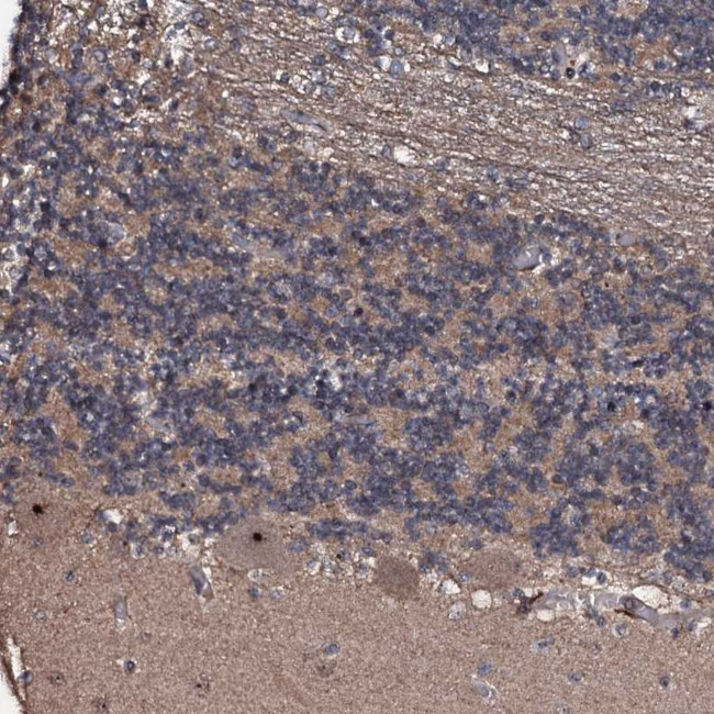 SUPT7L Antibody in Immunohistochemistry (Paraffin) (IHC (P))