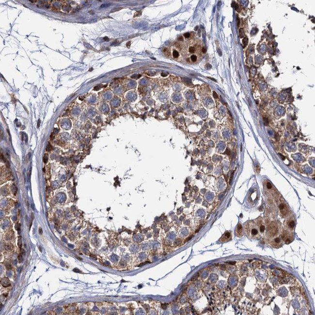 ALKBH7 Antibody in Immunohistochemistry (Paraffin) (IHC (P))