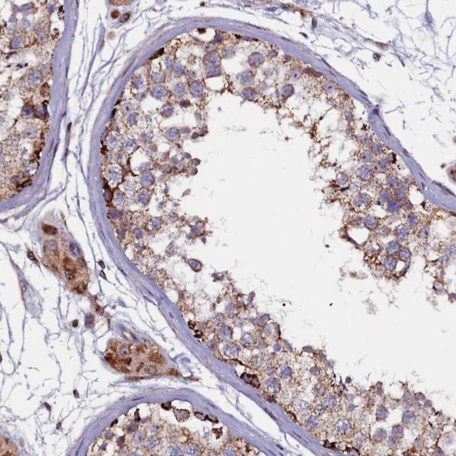 FUS2 Antibody in Immunohistochemistry (IHC)