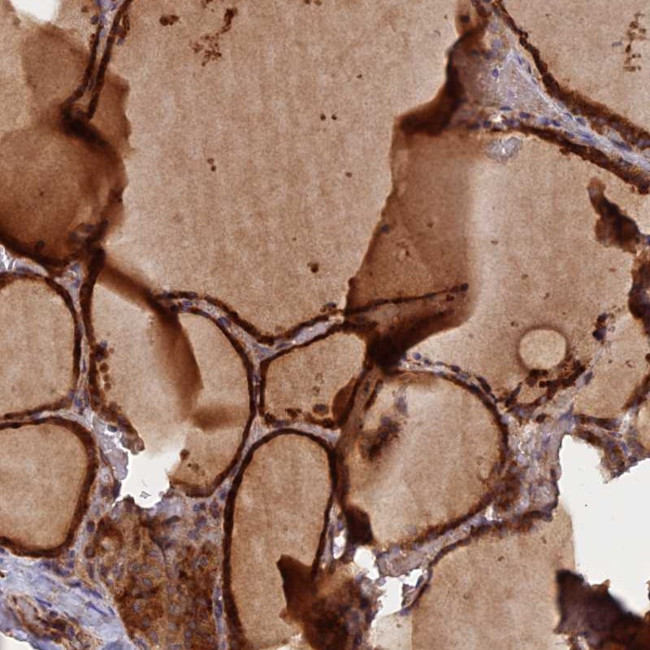 GMCL1 Antibody in Immunohistochemistry (Paraffin) (IHC (P))