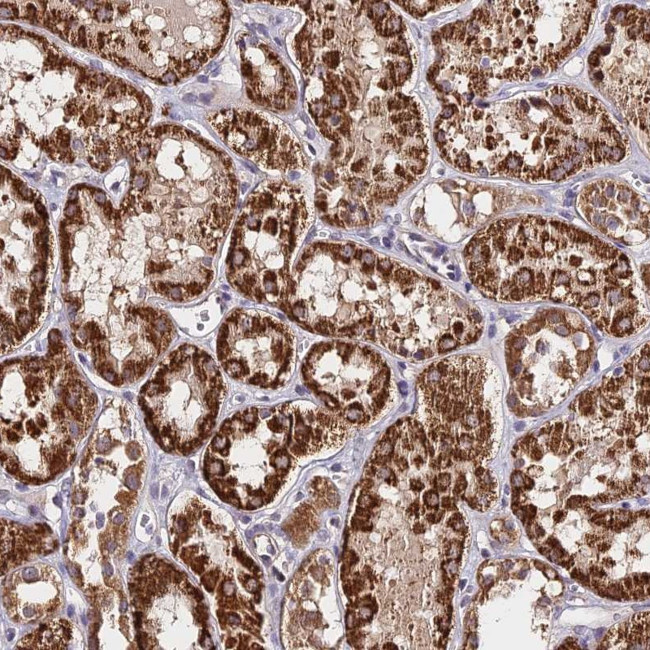 C3orf20 Antibody in Immunohistochemistry (Paraffin) (IHC (P))