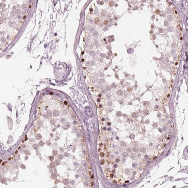 SPATA6L Antibody in Immunohistochemistry (IHC)