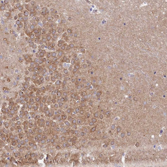 RGS7BP Antibody in Immunohistochemistry (Paraffin) (IHC (P))