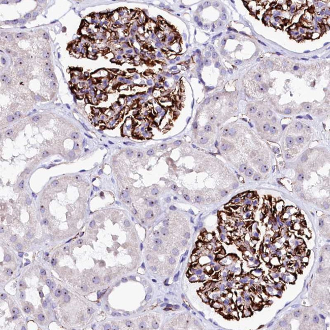 SFR1 Antibody in Immunohistochemistry (Paraffin) (IHC (P))
