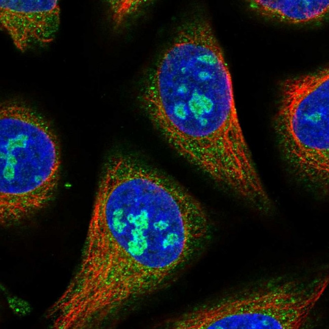 GTPBP4 Antibody in Immunocytochemistry (ICC/IF)