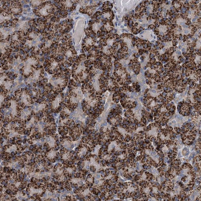 C6orf120 Antibody in Immunohistochemistry (Paraffin) (IHC (P))