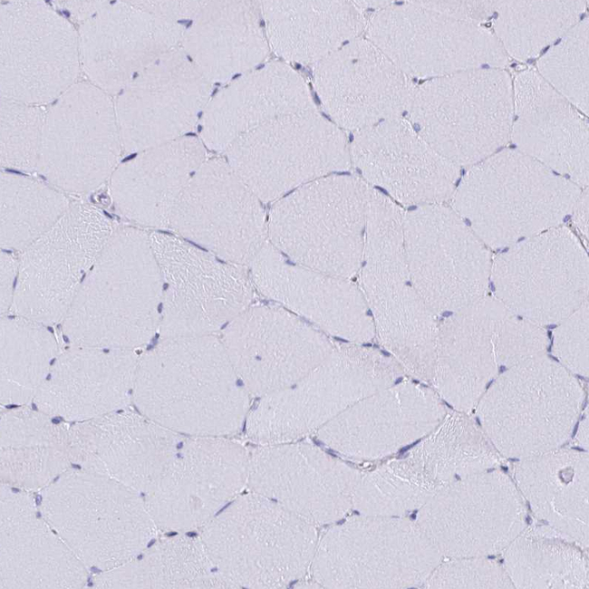 SCP3 Antibody in Immunohistochemistry (Paraffin) (IHC (P))