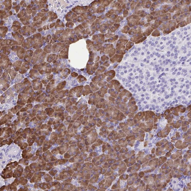 ERP27 Antibody in Immunohistochemistry (Paraffin) (IHC (P))