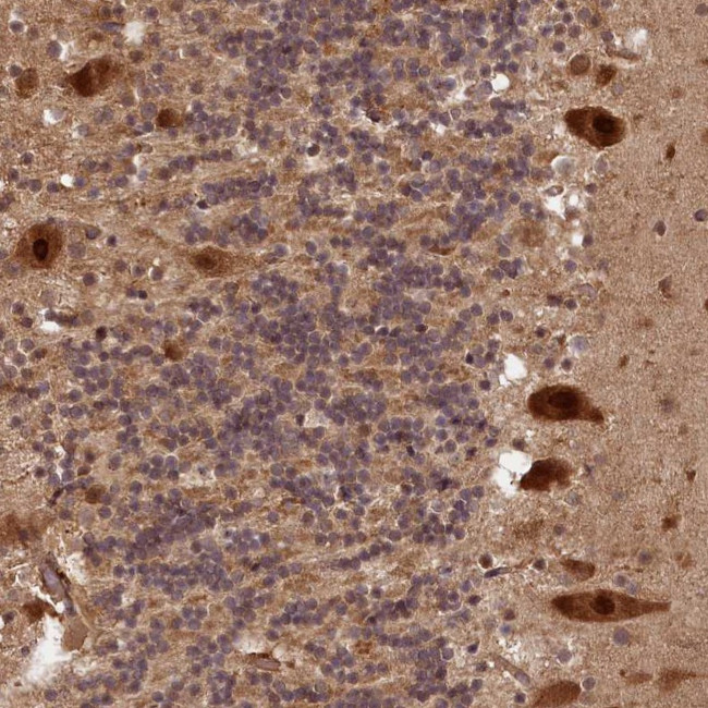 VPS51 Antibody in Immunohistochemistry (Paraffin) (IHC (P))