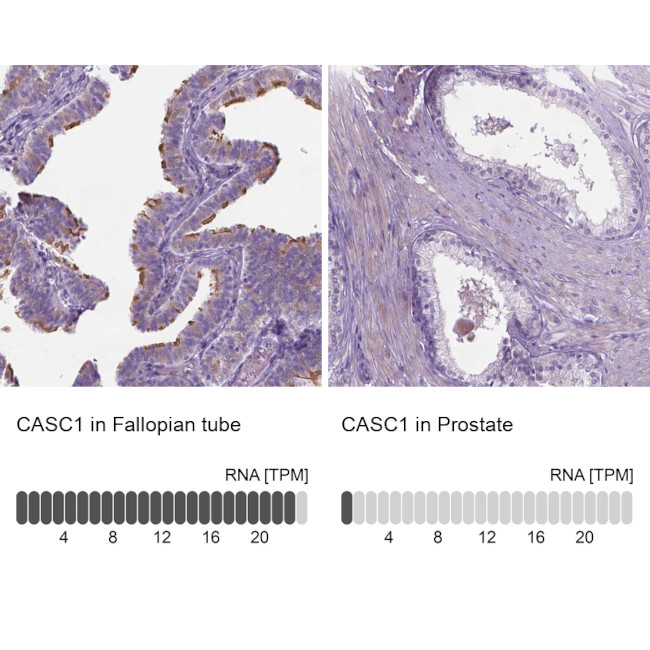 CASC1 Antibody in Immunohistochemistry (IHC)