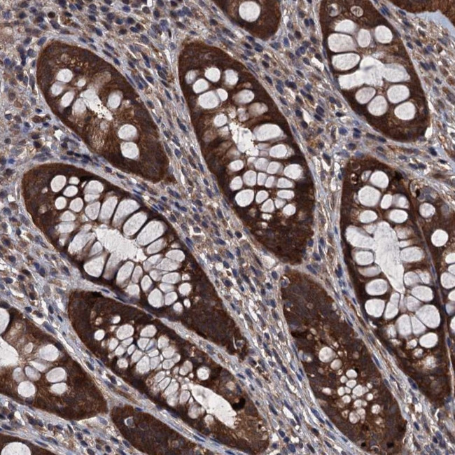 KIAA0701 Antibody in Immunohistochemistry (Paraffin) (IHC (P))