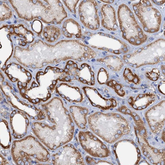 RASSF9 Antibody in Immunohistochemistry (Paraffin) (IHC (P))