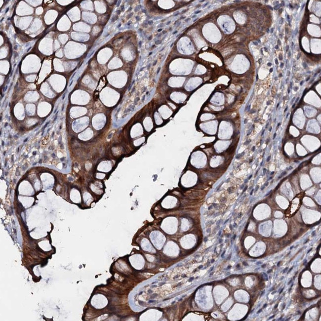 MANSC4 Antibody in Immunohistochemistry (Paraffin) (IHC (P))