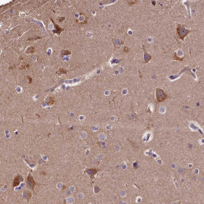 SPRYD3 Antibody in Immunohistochemistry (IHC)