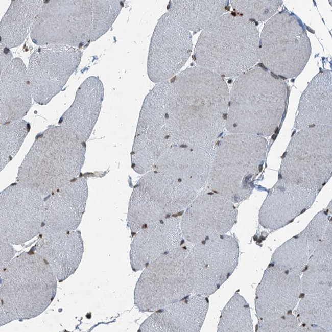 TCTN1 Antibody in Immunohistochemistry (IHC)