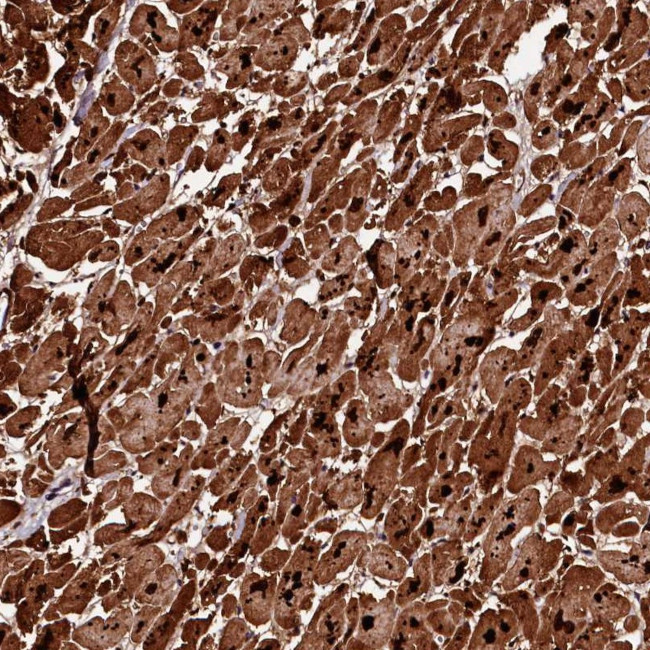 DIP13B Antibody in Immunohistochemistry (Paraffin) (IHC (P))