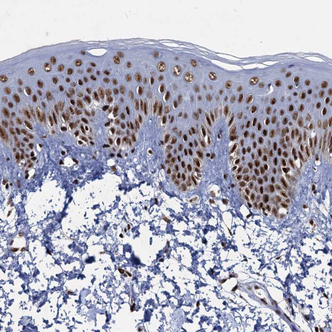 RPUSD4 Antibody in Immunohistochemistry (IHC)